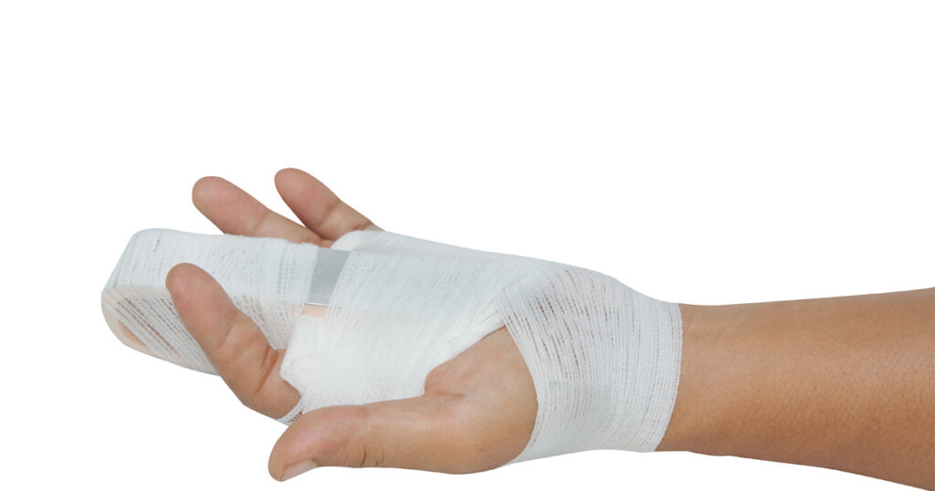 hand finger injury