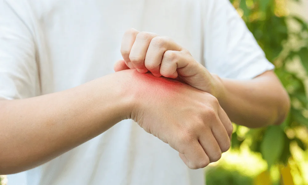 workers comp and occupational skin disorders